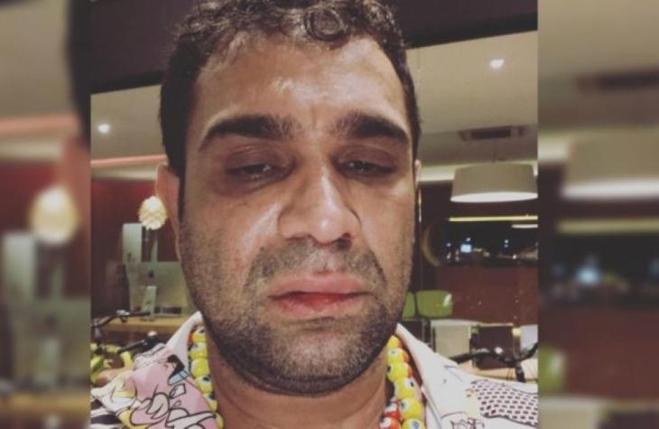 Humorista aceita acordo para indenização após denúncia de agressão em Marília