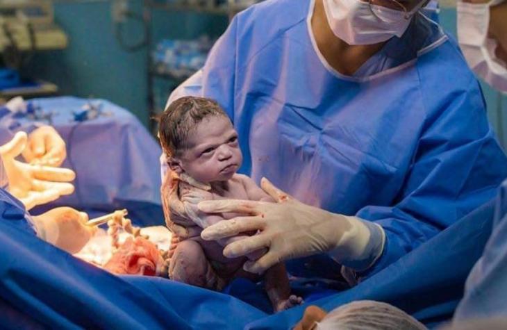 Bebê nasce com cara de ‘brava’ e imagem viraliza na internet