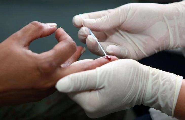 Em meio à pandemia, cientistas avançam em estudos de vacinas contra câncer e HIV