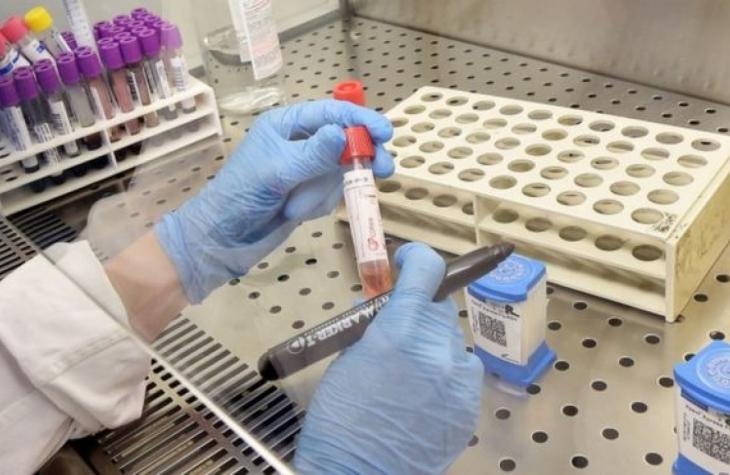 O que se sabe sobre o primeiro paciente diagnosticado com doença no Brasil