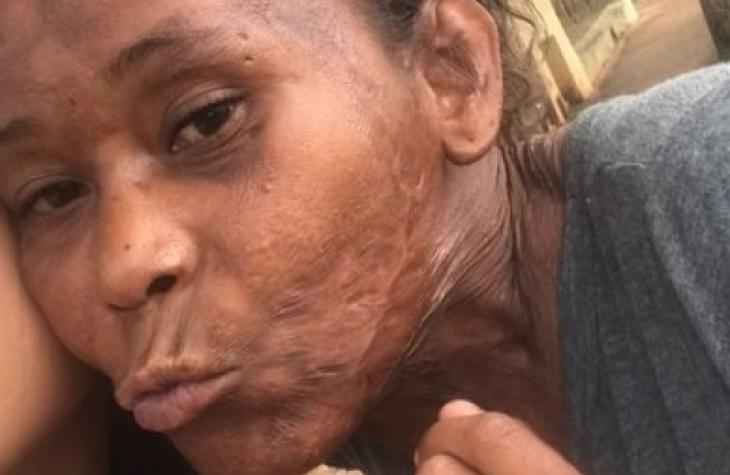 Mulher morre em Hospital de Marília após ser atacada por três pitbull