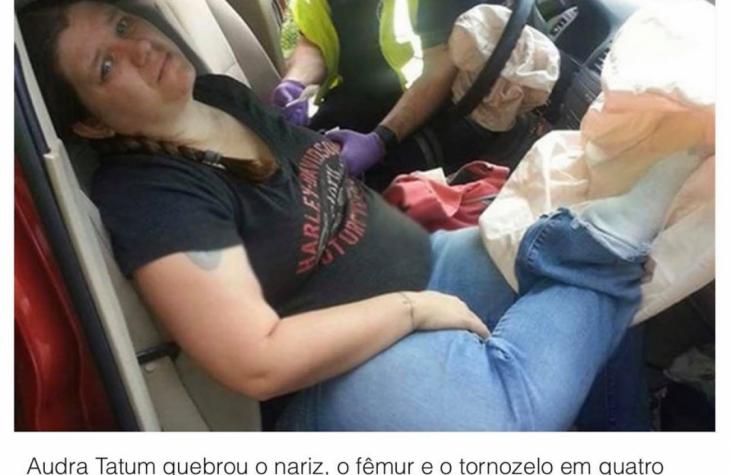 Jovem sofre graves lesões em acidente ao apoiar os pés no painel do carro 