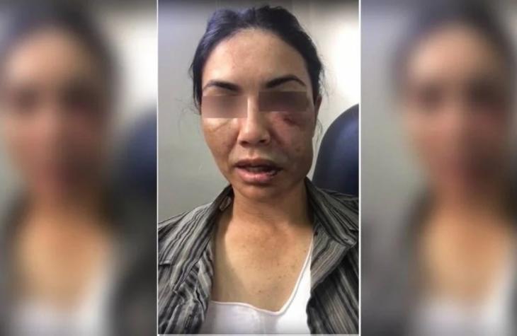 Motorista é jogada de ponte e se finge de morta para fugir de ladrões